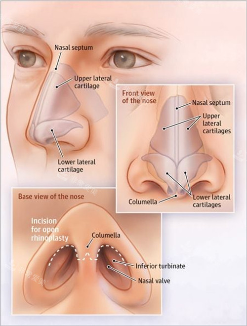 鼻修復(fù)細(xì)節(jié)圖一覽