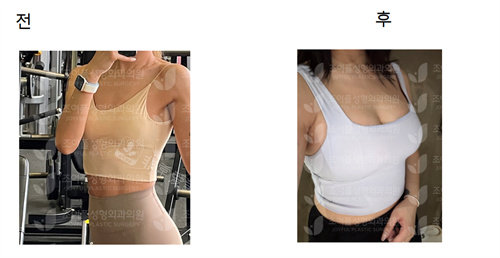 喜悦整形实例对比