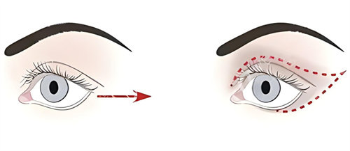 眼综合对比图 眼综合对比图
