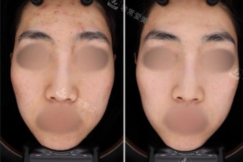 GreenY皮肤科对比图