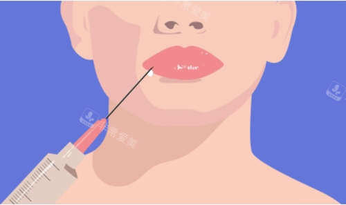 注射美容卡通圖 注射美容卡通圖