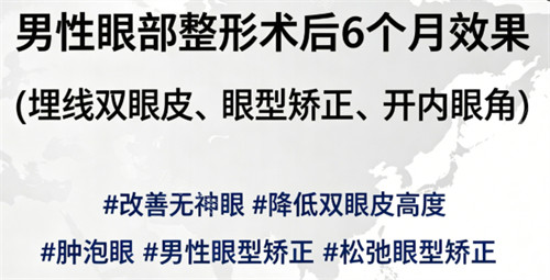 韩国Sone整形外科35岁...