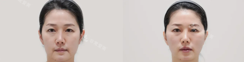 韩国DICARAT新沙医院